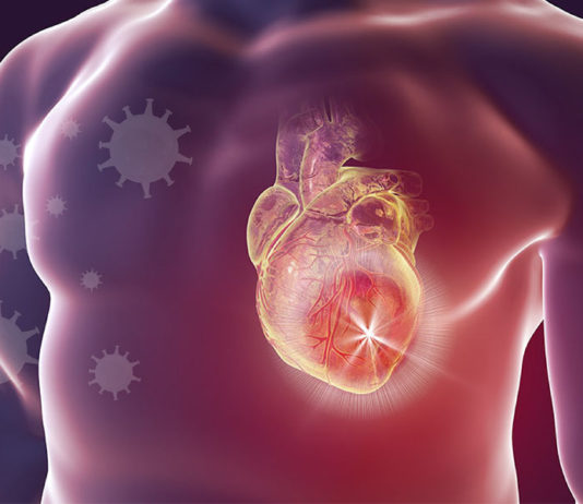 O que acontece quando 3 bilhões de pessoas vacinadas têm miocardite não diagnosticada?