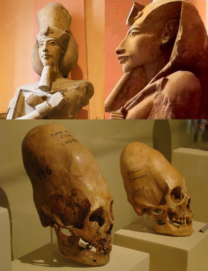 O "faraó herege" Akhenaton era um hibrido extraterrestre 2