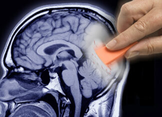 Dr. Joel Wallach – O Alzheimer é uma doença causada por médicos