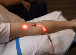 Combatendo infecções e doenças crônicas com terapia de ozônio e luz ultravioleta (UBI)