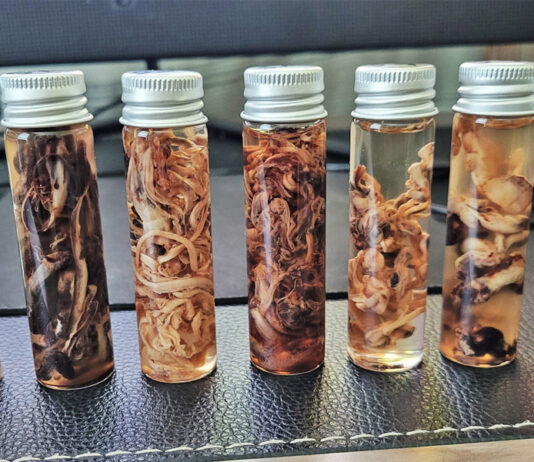Os nanorrobôs nas vacinas são a causa dos filamentos brancos encontrados nos cadáveres dos vacinados?