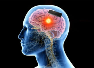 Crescem os números de distúrbios neurológicos e suicídios inexplicáveis entre pessoas vacinadas.